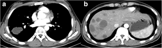 Fig. 17