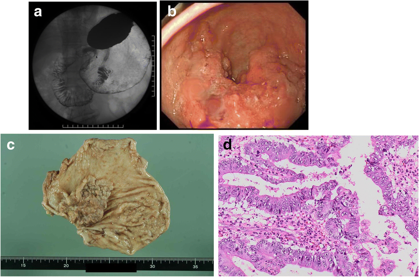 Fig. 1