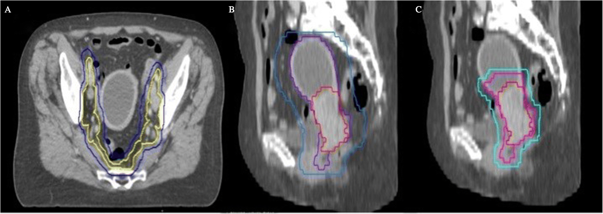 Fig. 2