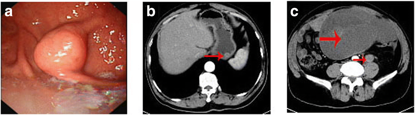 Fig. 1