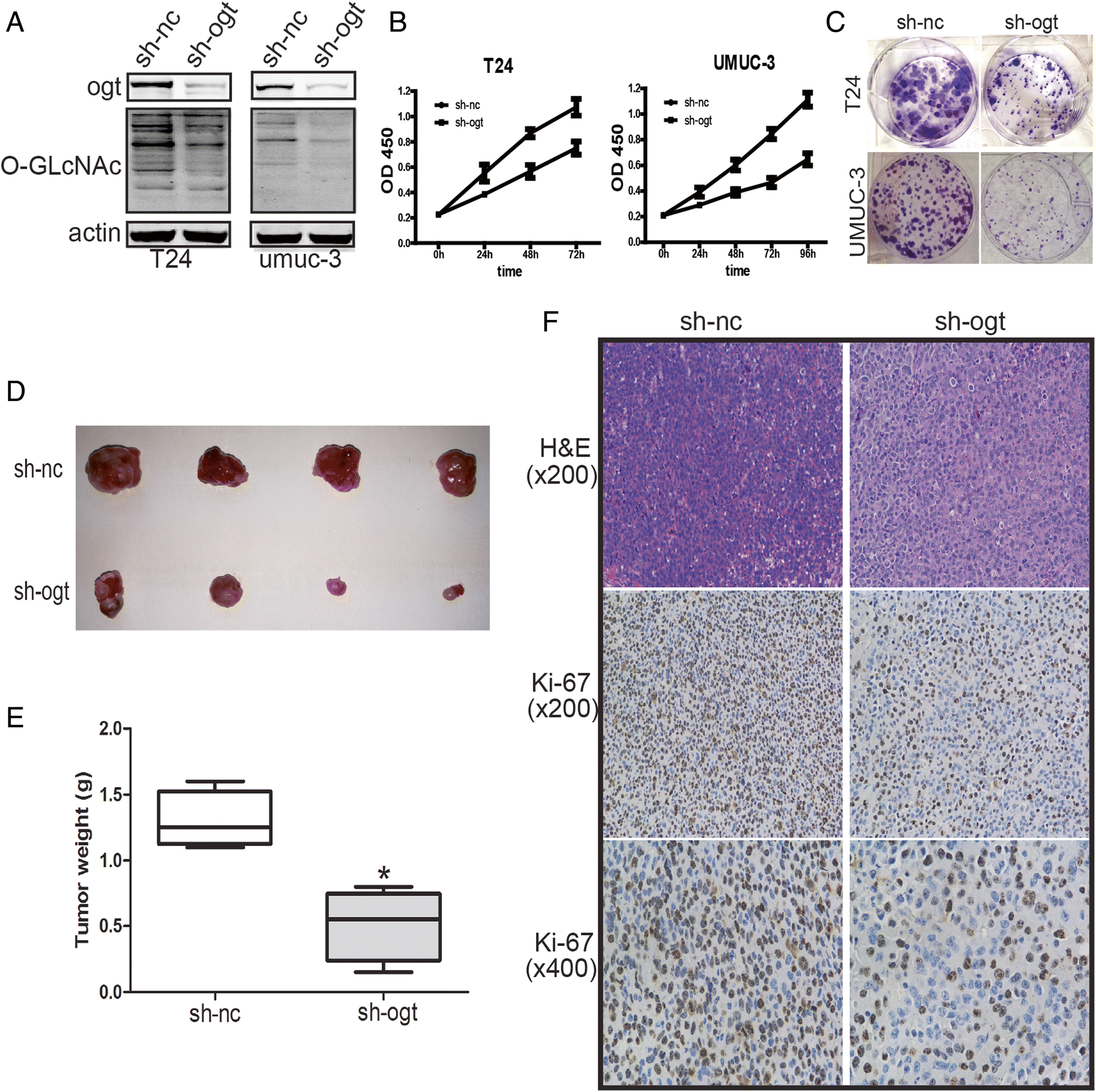 Suppressed Ogt Expression Inhibits Cell Proliferation While Inducing Cell Apoptosis In Bladder Cancer Bmc Cancer Full Text