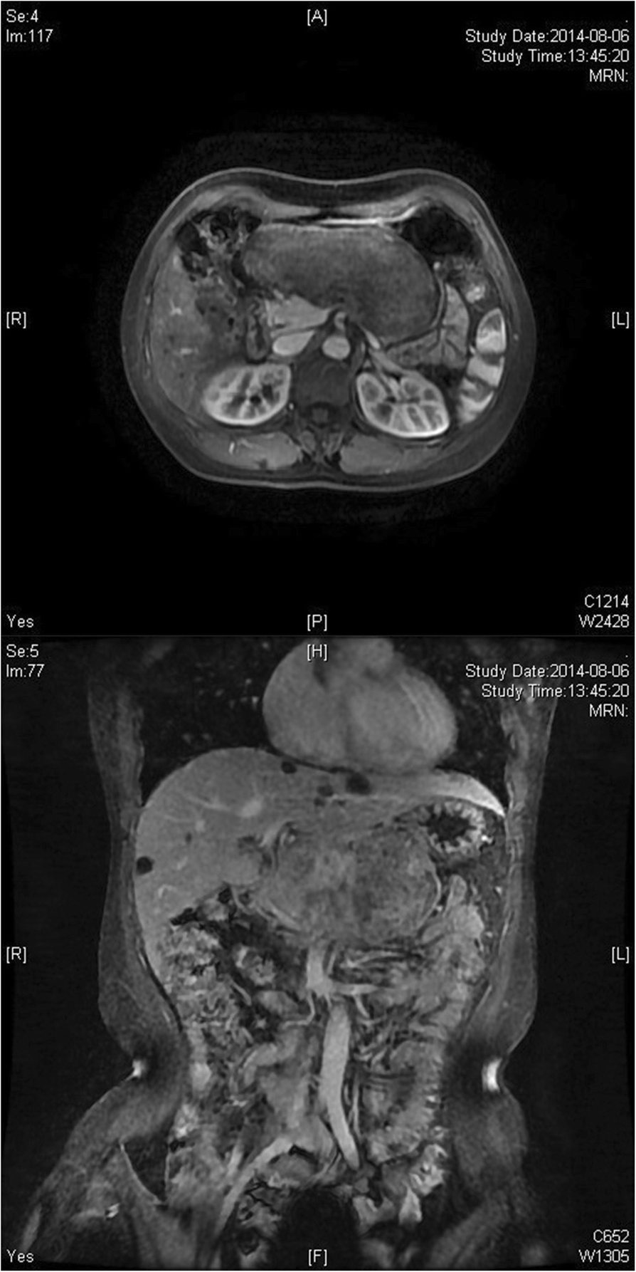 Fig. 2