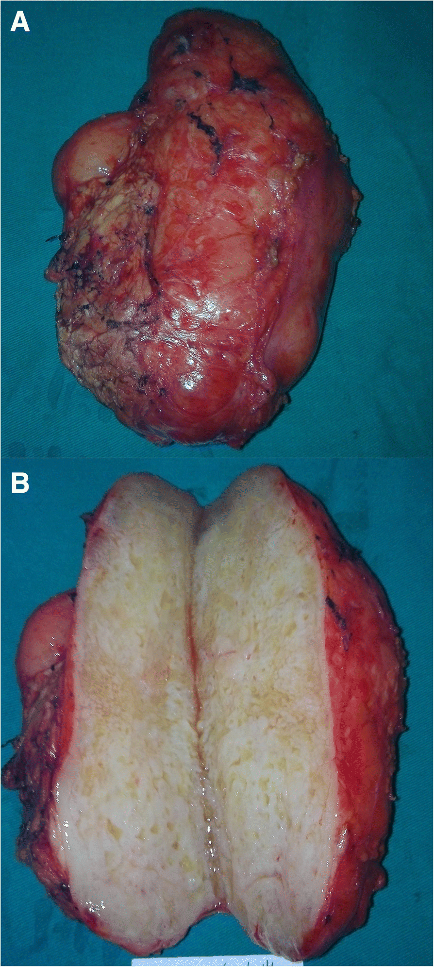 Fig. 3