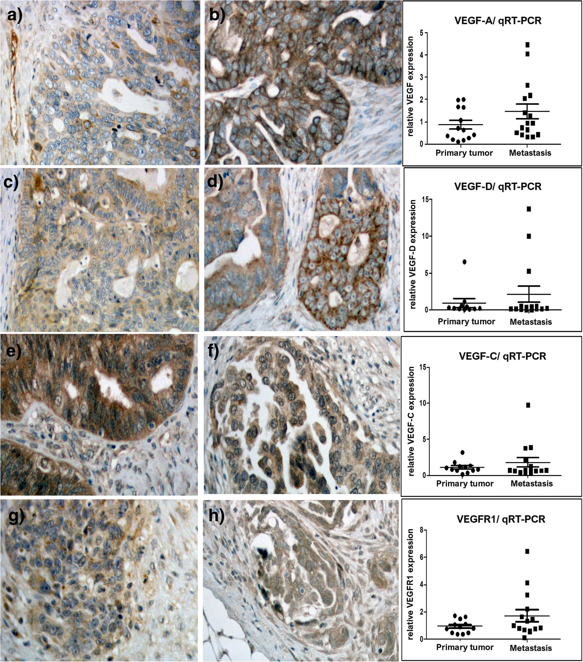 Expression Profiles Of Vegf A Vegf D And Vegfr1 Are Higher In Distant Metastases Than In Matched Primary High Grade Epithelial Ovarian Cancer Bmc Cancer Full Text