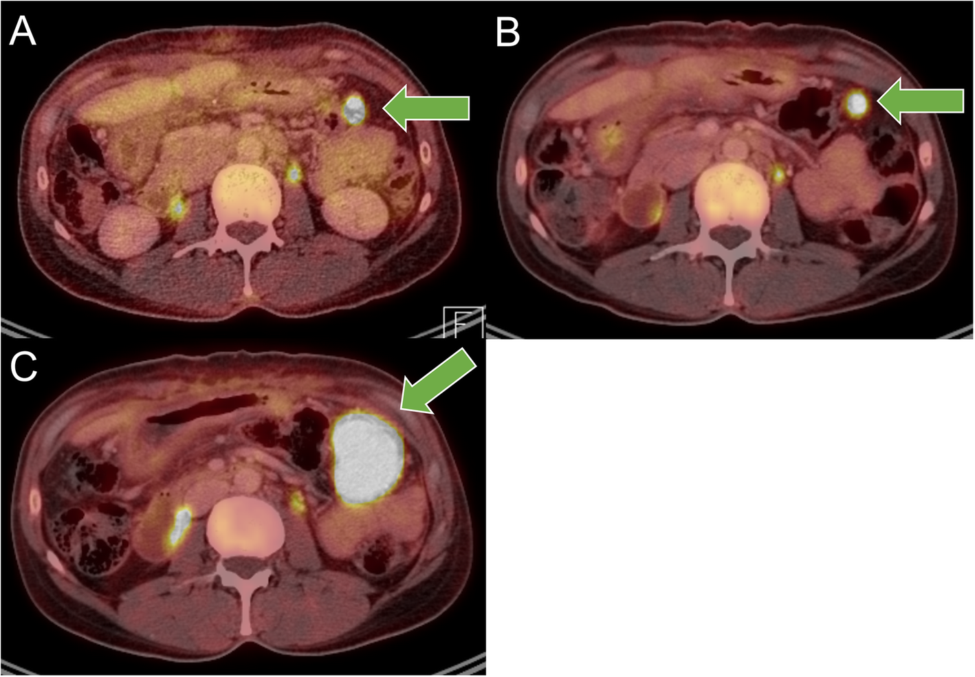 Fig. 3