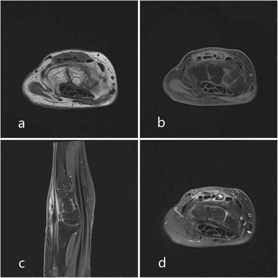 Fig. 1