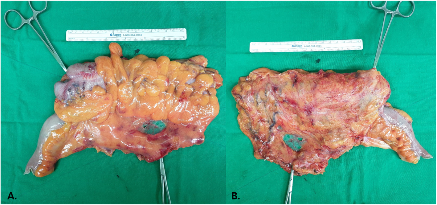 Fig. 4