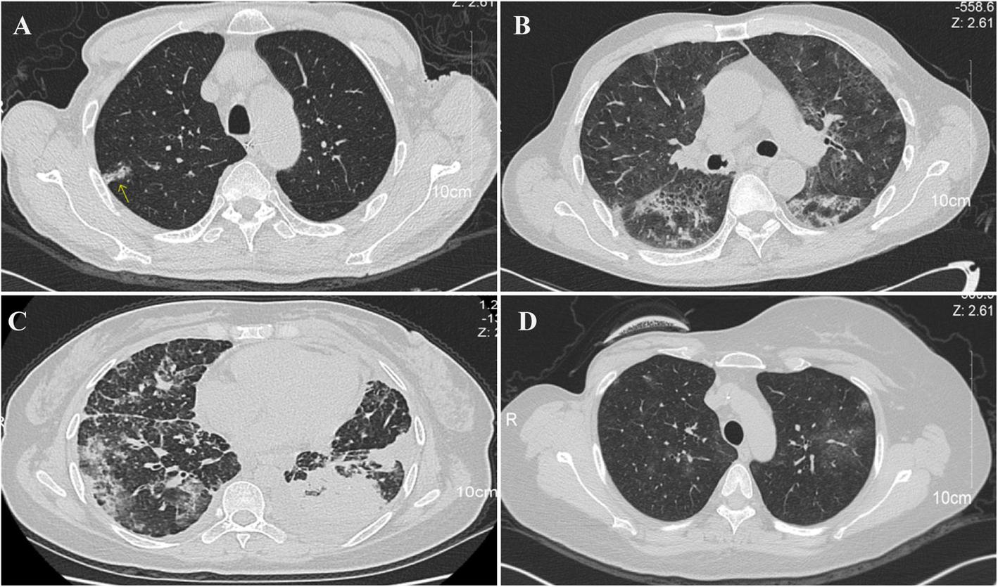 Fig. 2