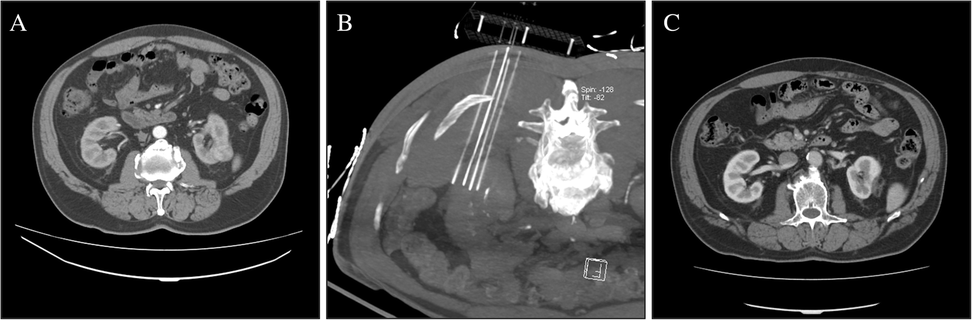 Fig. 2