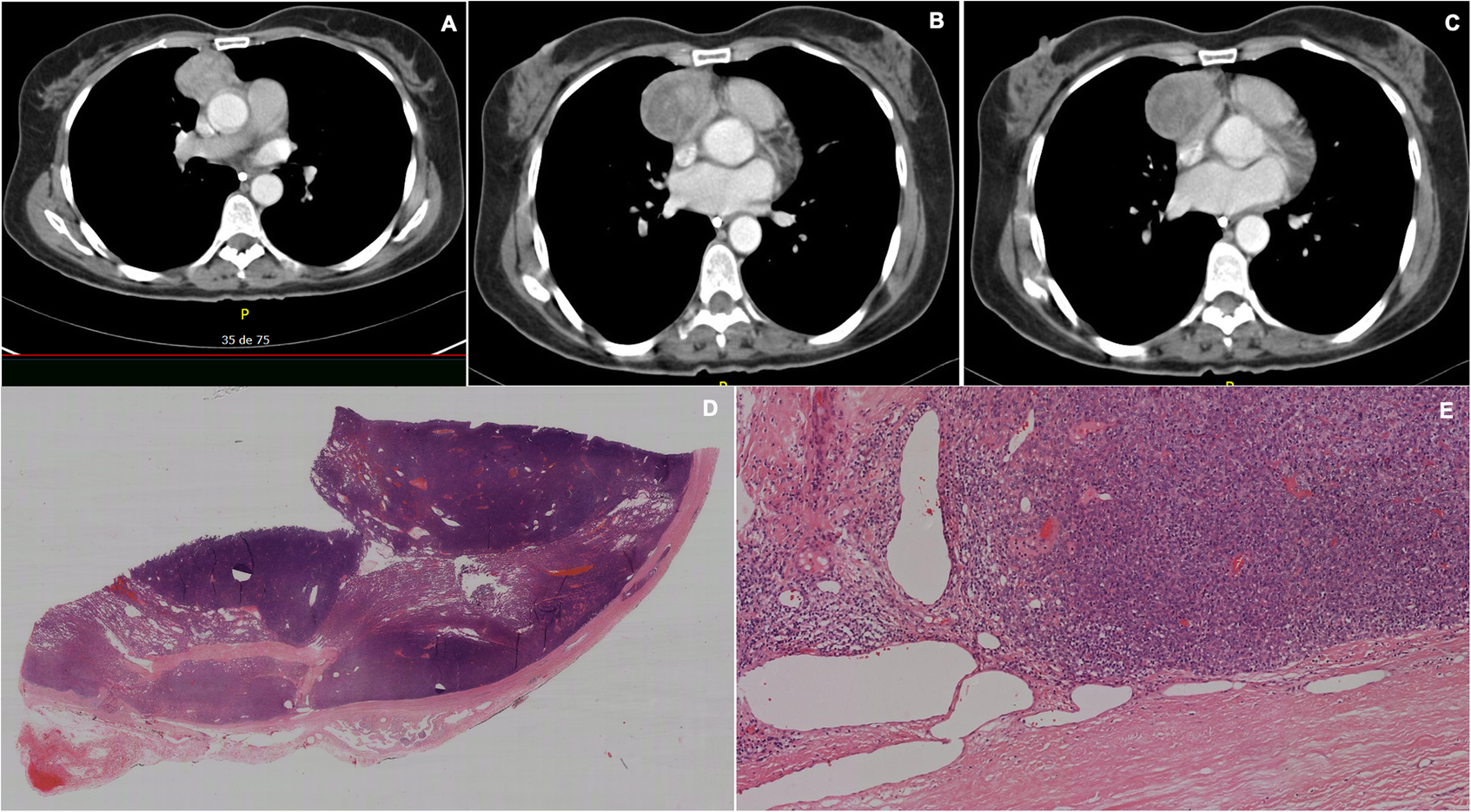 Fig. 4