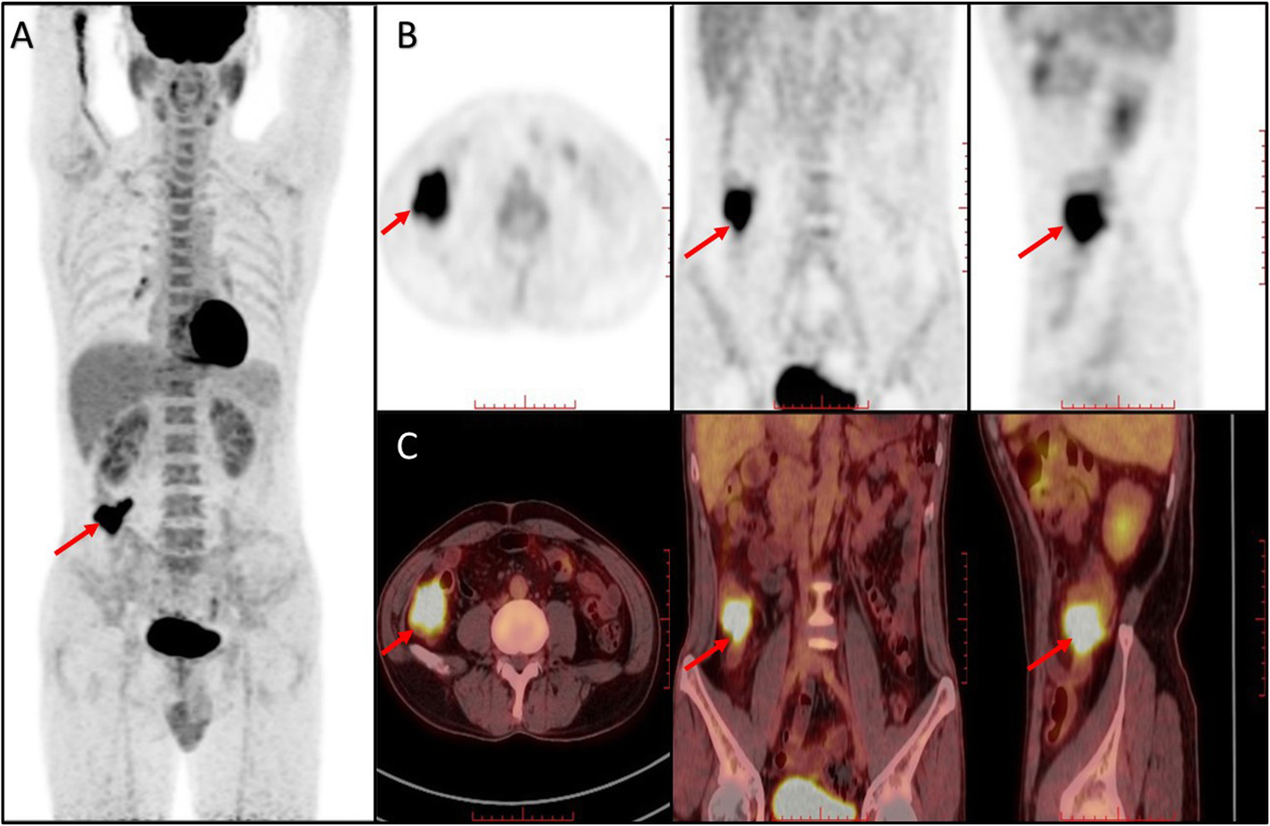 Fig. 2