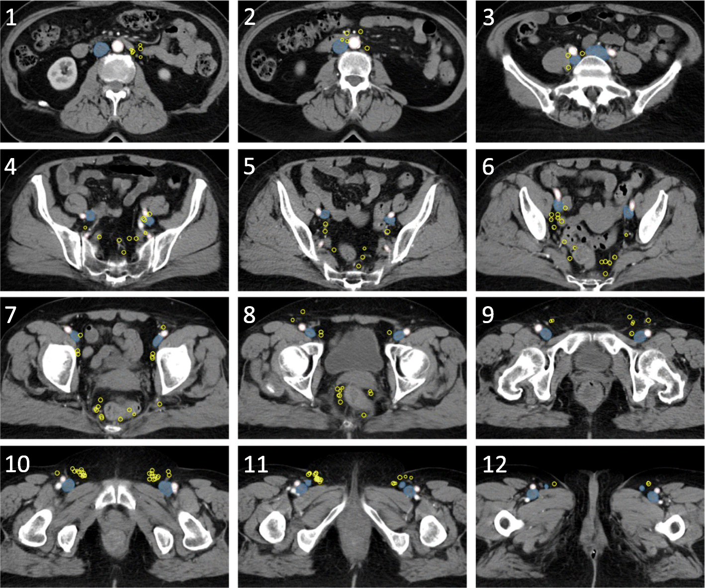 Fig. 2