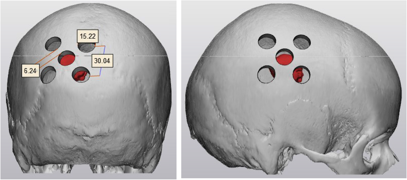 Fig. 1