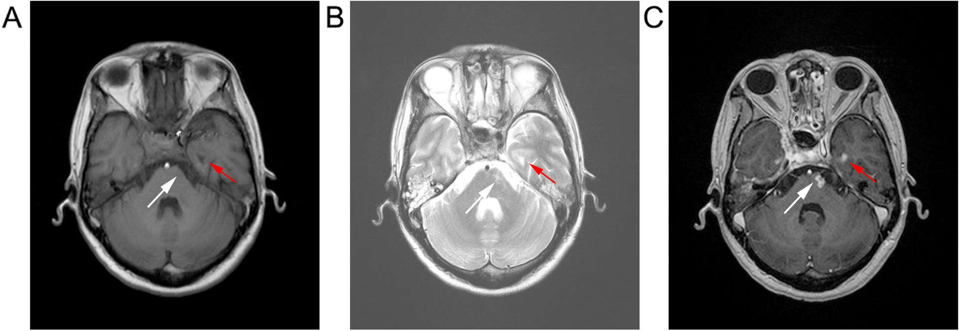 Fig. 1