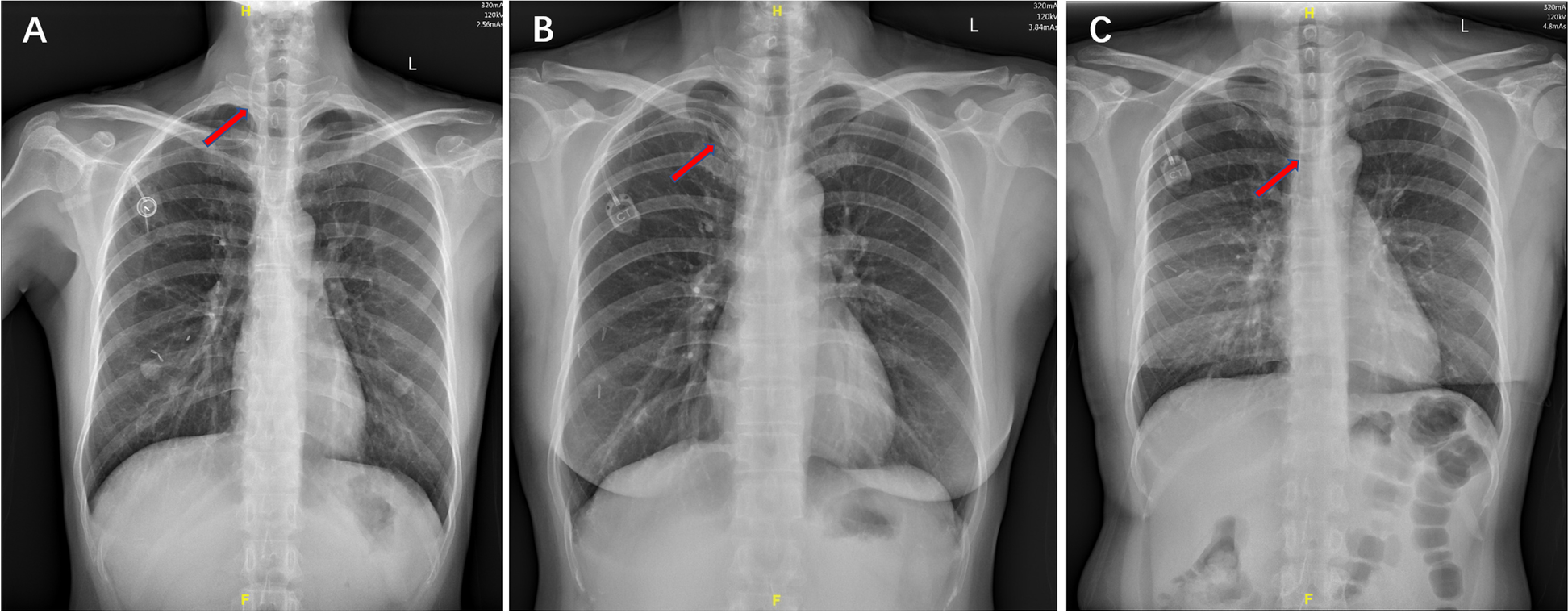 Fig. 5