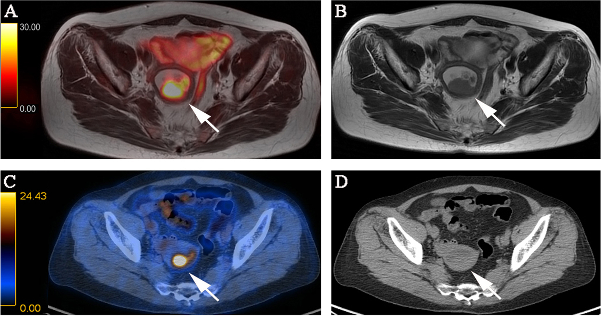 Fig. 2