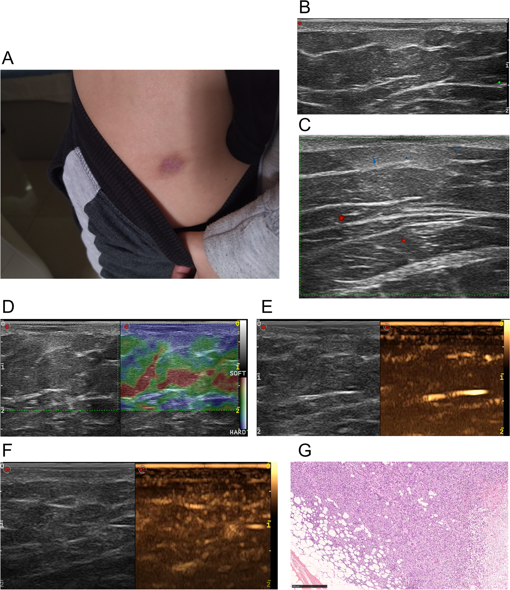 Fig. 4