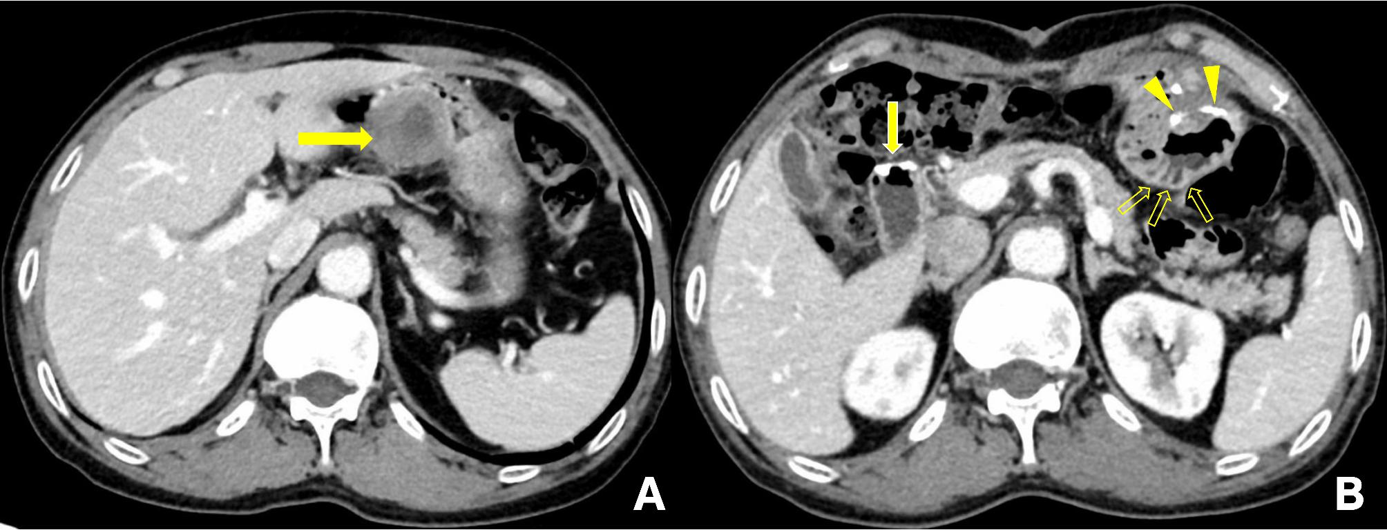 Fig. 1