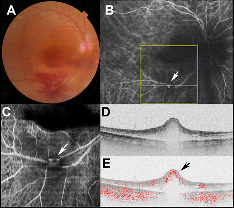 Fig. 2