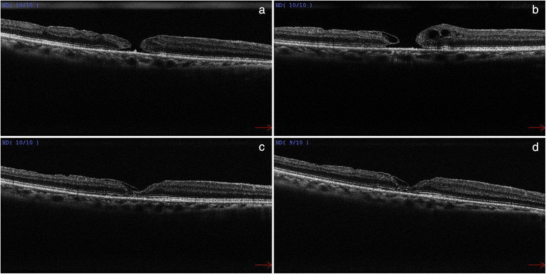 Fig. 2