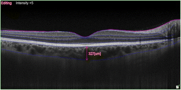 Fig. 2