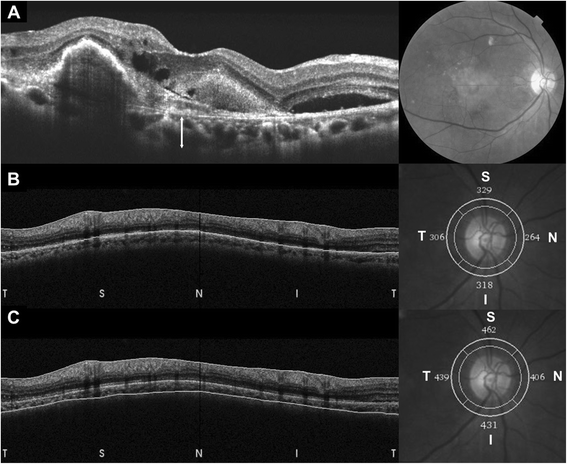 Fig. 1