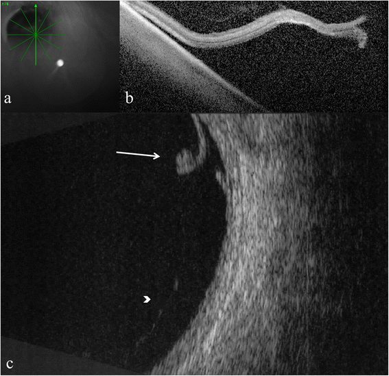 Fig. 5