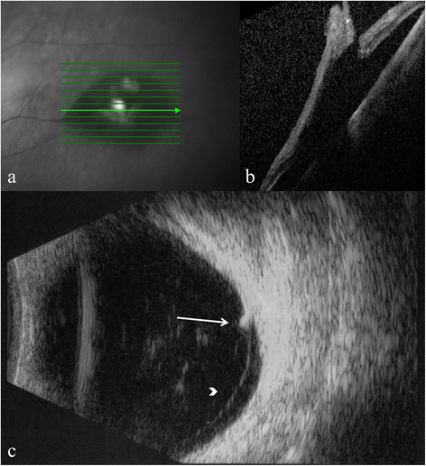 Fig. 6