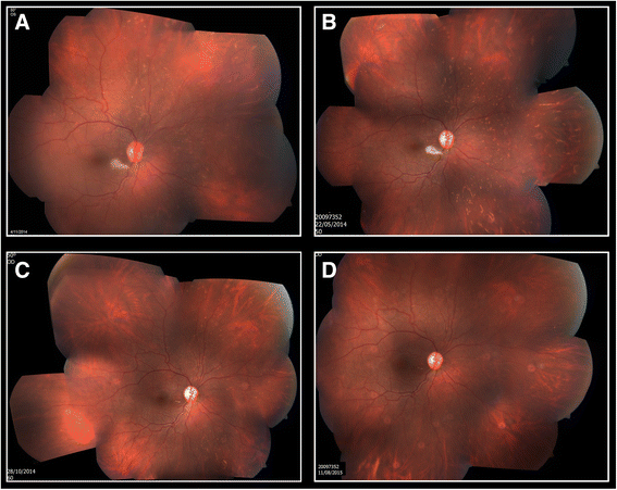 Fig. 3