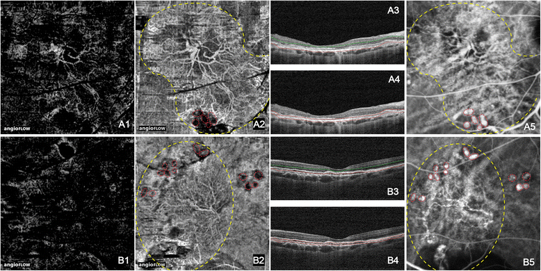 Fig. 3