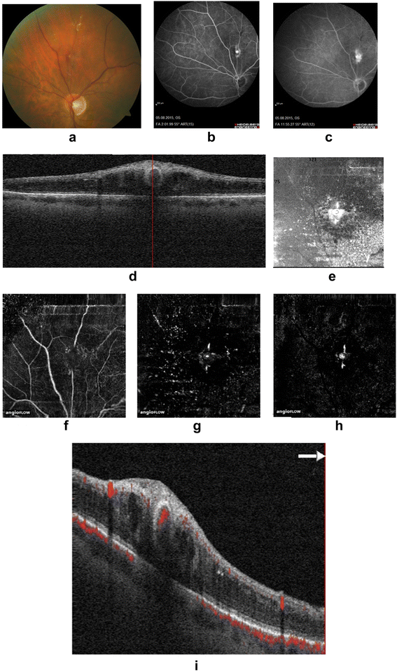 Fig. 1