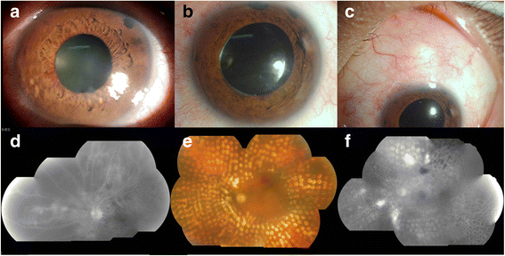 Fig. 4