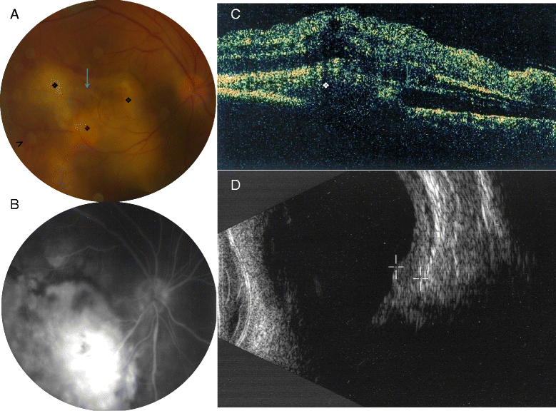 Fig. 1