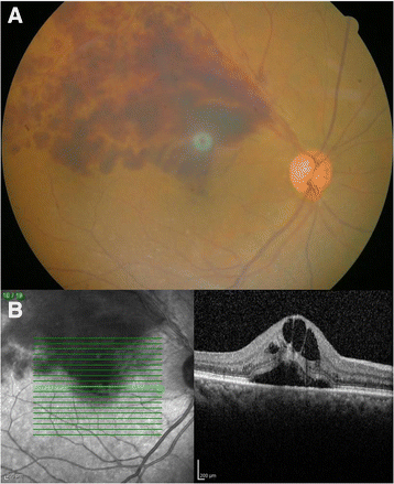 Fig. 1