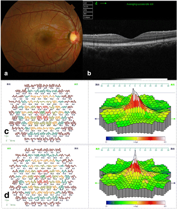 Fig. 2