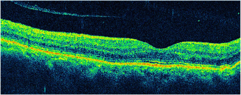 Fig. 7