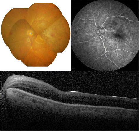 Fig. 3