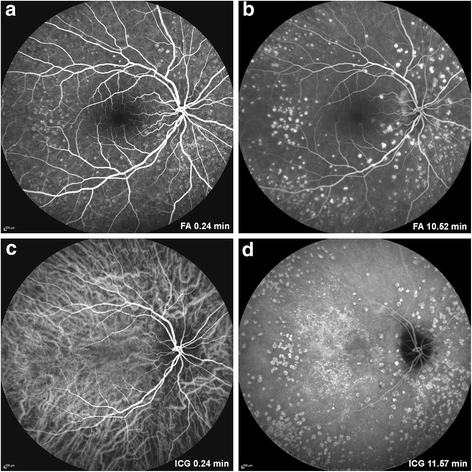 Fig. 4