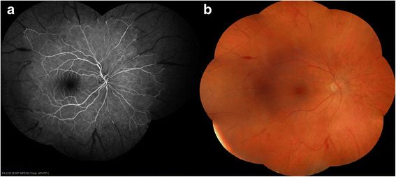 Fig. 1