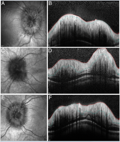 Fig. 3