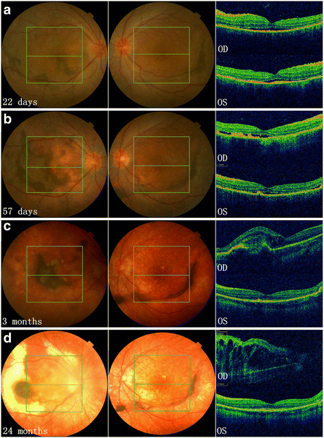 Fig. 2