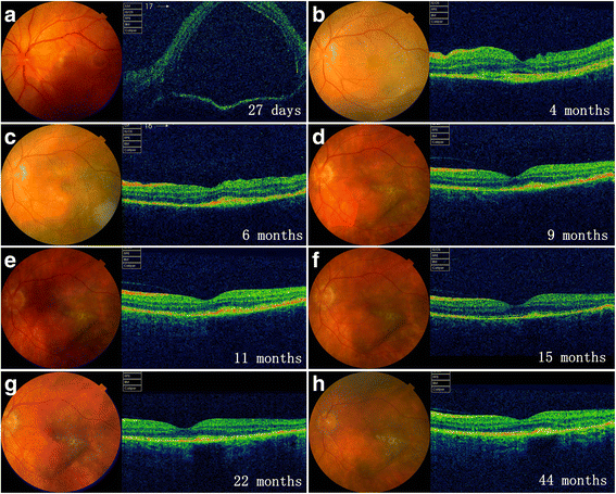 Fig. 3