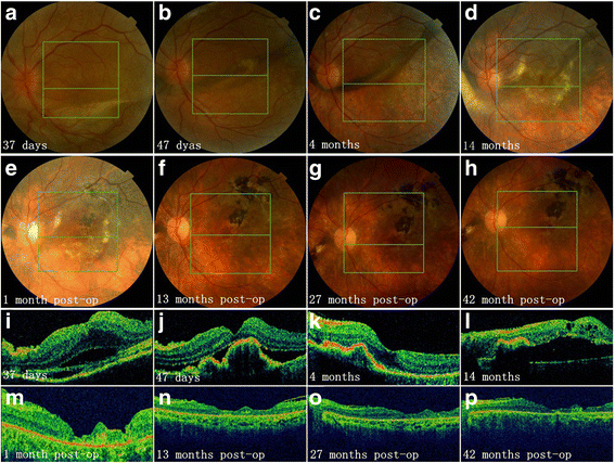 Fig. 4