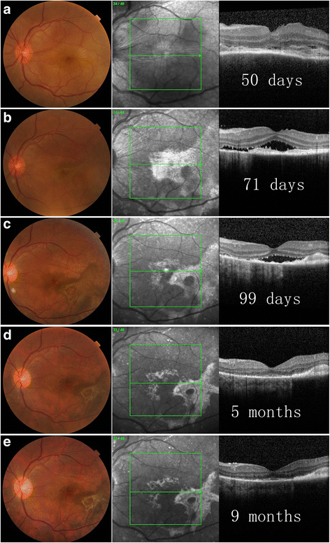 Fig. 5