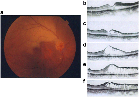 Fig. 1