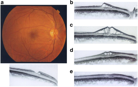 Fig. 2