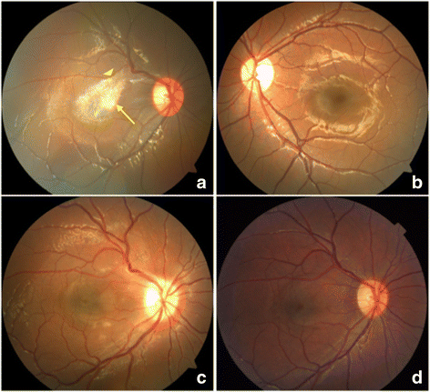 Fig. 1