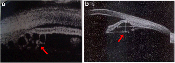 Fig. 10