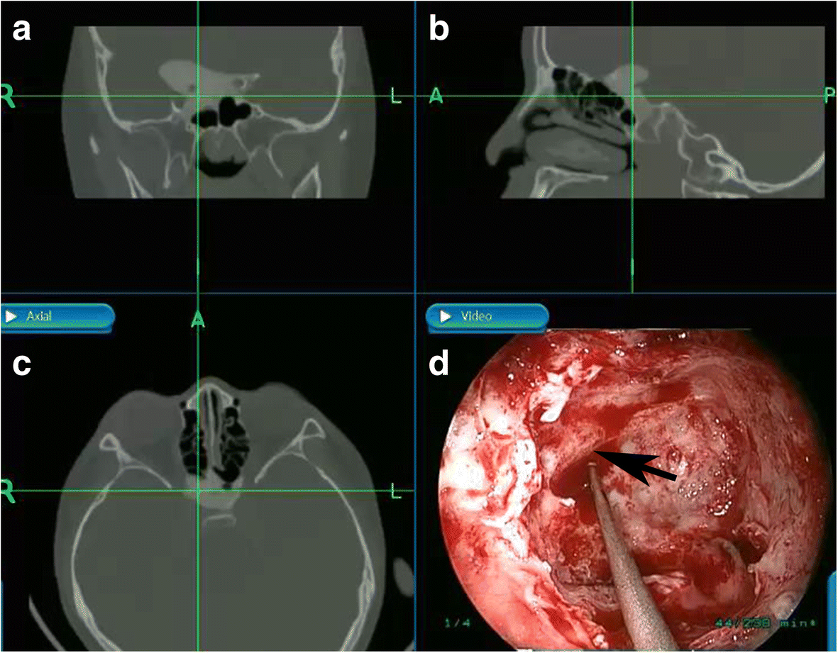 Fig. 2