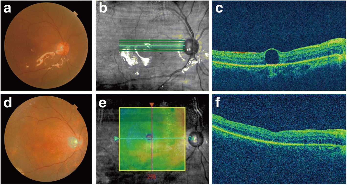 Fig. 3